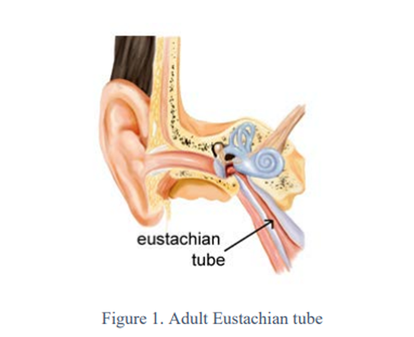 Eustachian Tube Dysfunction