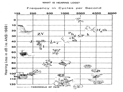 Sound frequency chart - Ashland ENT