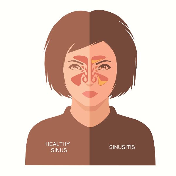 When Is My Sinus Problem Chronic? | Ashland ENT in Ashland Ohio